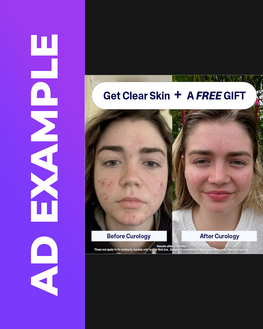 Before & After (Bundle #3)