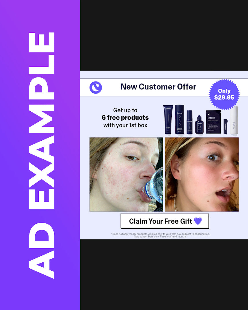 Before & After (Bundle #3)